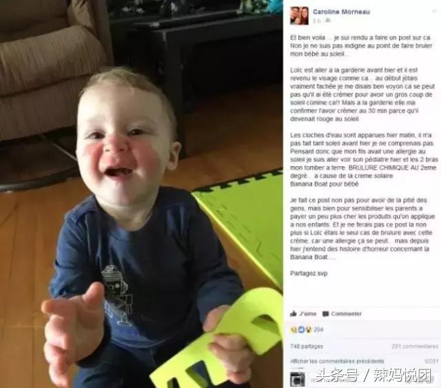 宝宝防晒霜使用不当会造成灼烧？烧烤模式般的天气下，宝宝防晒怎么选，防晒霜怎么用？