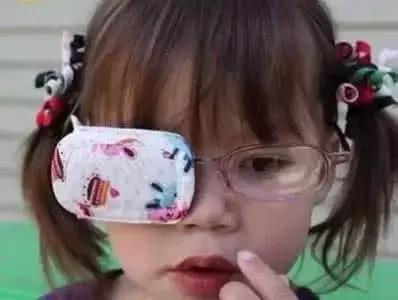 儿童眼睛弱视的例子,儿童弱视眼科治疗方法