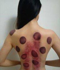 湿气重苦不堪言，怎么祛除体内湿气，叫你一招，轻松祛湿！