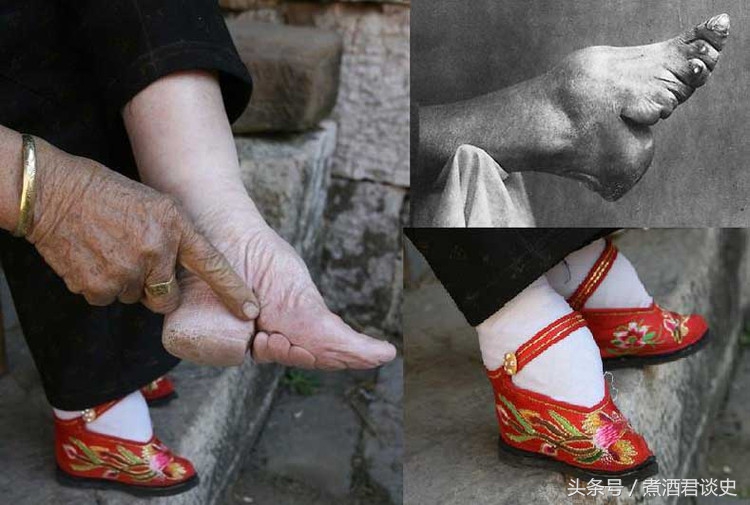 从为“三从四德”招魂的丁璇说中国古代的缠足