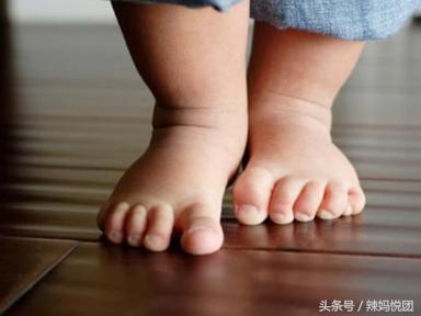 宝宝走路不稳容易摔倒怎么改善,足外翻儿童踮脚训练要多少次