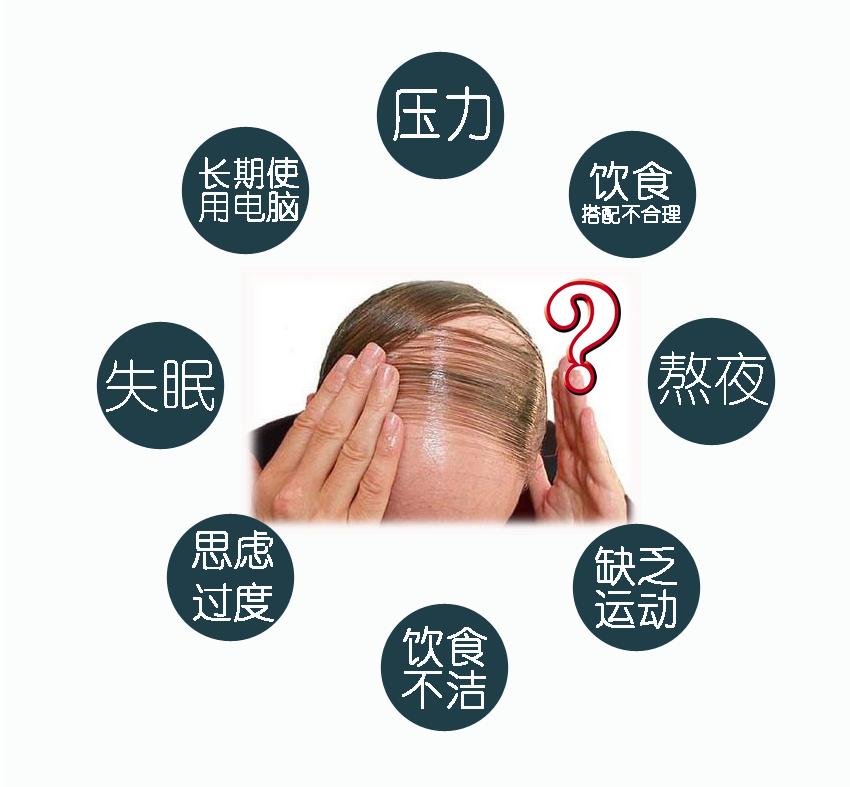 脱发有多苦恼,脱发严重的3大原因你知道吗