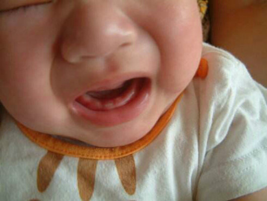 为什么有的宝宝长牙会发烧,宝宝长牙发烧一般情况下发烧几天