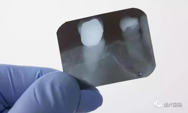 孕妇牙疼怎么办？忍着还是看牙医？