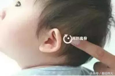 小儿感冒最快的治疗方法,宝宝感冒咳嗽推拿穴位图