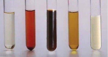 蛋白、潜血患者如何避免10~30年不发展成尿毒症？