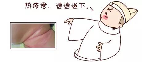 湿疹跟热疹的区别尿布疹,新生儿湿疹或热疹尿布疹怎么判断
