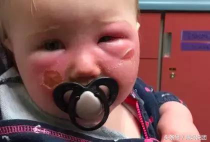 宝宝防晒霜使用不当会造成灼烧？烧烤模式般的天气下，宝宝防晒怎么选，防晒霜怎么用？