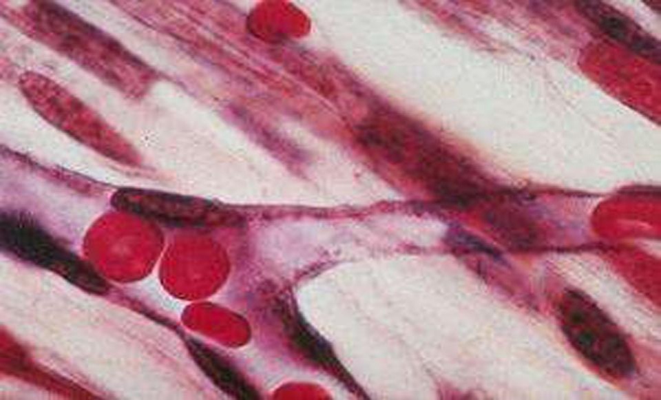 发红、水泡、溃疡……不同阶段的褥疮该接受怎样的治疗？