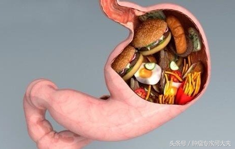 早期胃癌术后复发转移到肺脏,胃癌复发腹膜转移用靶向治疗好吗