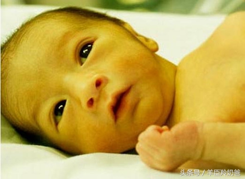 黄疸值超过这个数字会伤害大脑！关于黄疸，父母不可不知这4点