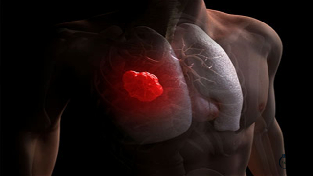 小康每日说：转移因子口服液是肺癌用药吗？具体功效是什么？