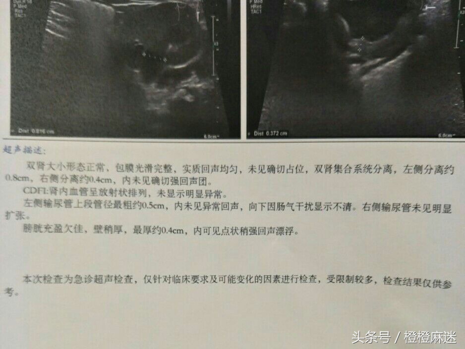 三个月宝宝尿路感染要治疗多久,四个月宝宝尿路感染反反复复