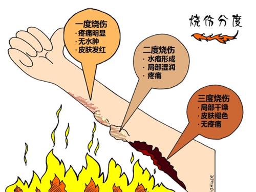 烧烫伤急救的最好方法,孩子夏天防烧烫伤