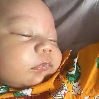 新生儿的六种异常状况,新生儿几大正常现象