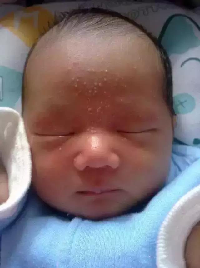 新生儿的六种异常状况,新生儿几大正常现象