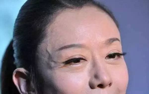 李铁红身体状况,李铁红致病原因