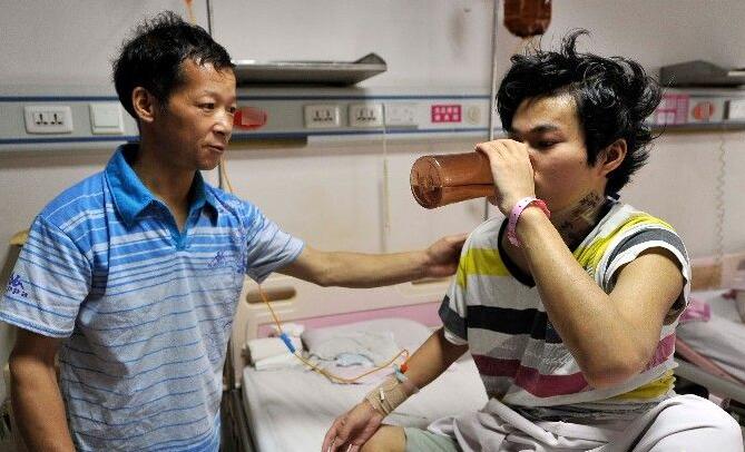 新型隐球菌脑膜炎好转症状,新型隐球菌脑膜炎症状儿童