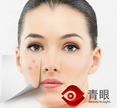 只不过因为在敏感季用了年前的化妆品，她再也不想去踏春了！