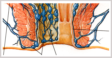 她肛门涨的难受，非常不舒服，以为有啥不好的事情呢