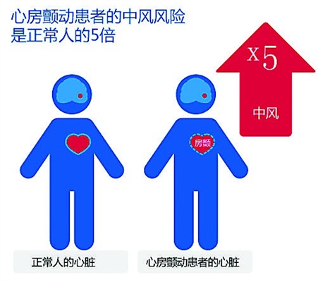 房颤室颤究竟是什么？哪个能够要人命？