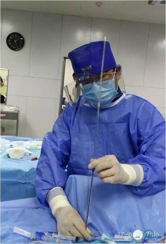 静脉窦狭窄支架植入术,静脉窦狭窄做支架多少钱