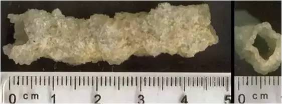 瘦成一道闪电了是什么样,瘦成一道闪电有多粗