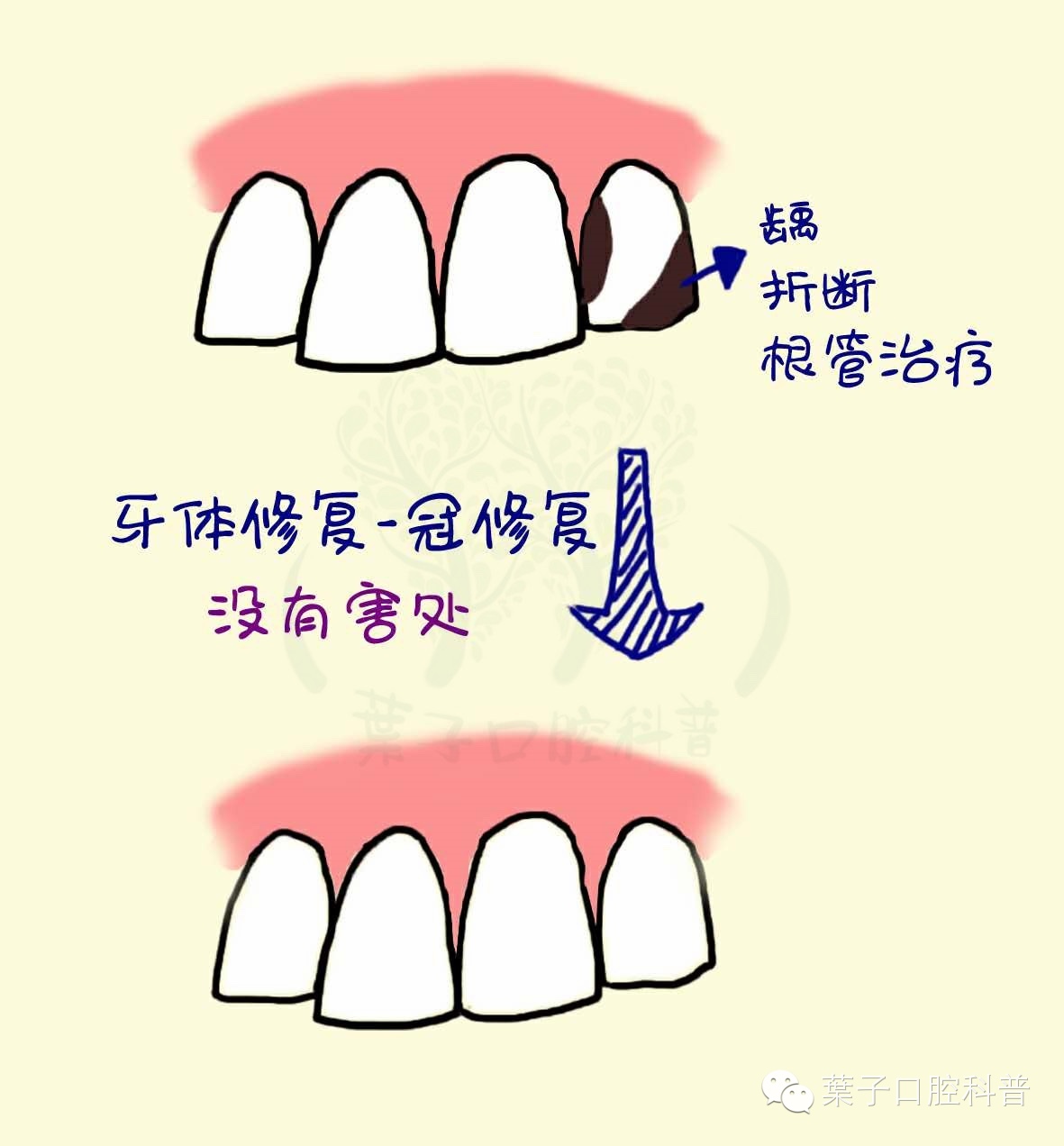 葉子口腔科普,口腔美容知识科普