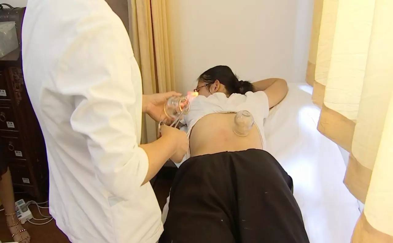 男子拔火罐被烧伤,男子拔罐被烧伤