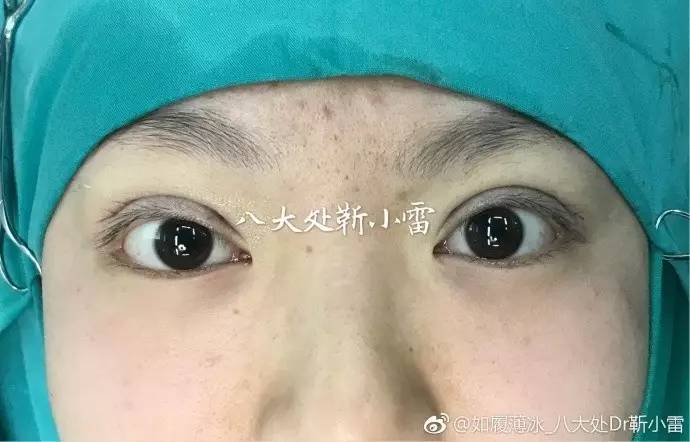 为什么医生不给自己手术,为什么医生不敢给亲人做手术