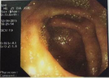 腹胀是怎么回事小心是这里生病了,腹胀是什么原因引起的胃不舒服