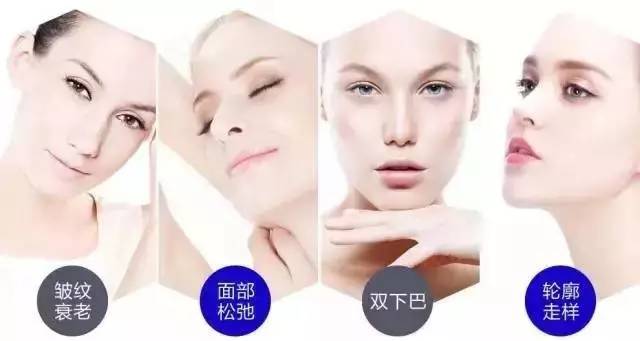 比皱纹更可怕的是面部松弛,五十岁面部松弛皱纹怎么办