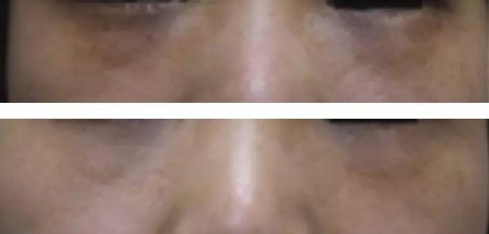 遮眼下黑眼圈细纹用什么遮瑕好,如何遮瑕遮掉黑眼圈细纹法令纹