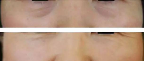 遮眼下黑眼圈细纹用什么遮瑕好,如何遮瑕遮掉黑眼圈细纹法令纹