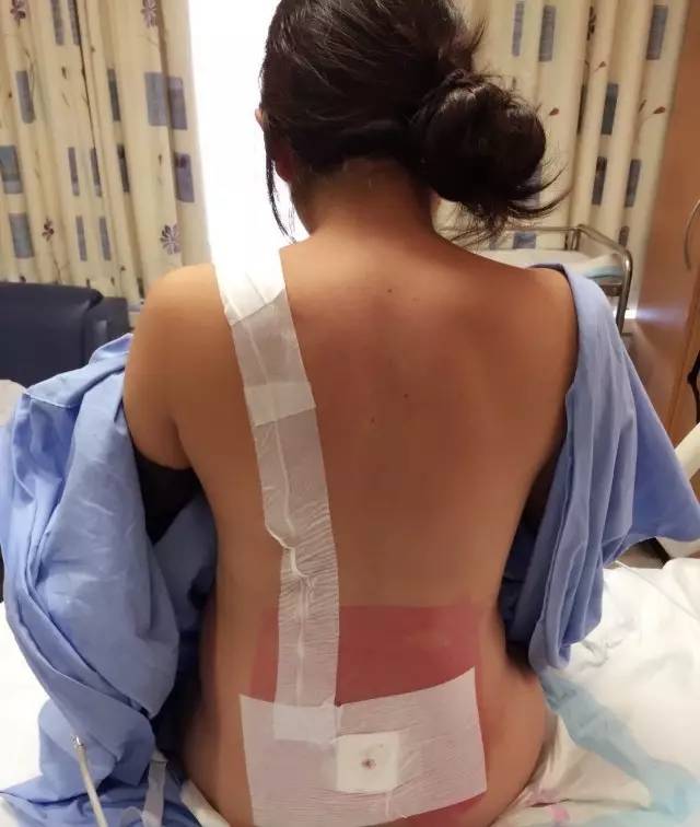 谁说生孩子一定要痛？你可以了解一下“无痛分娩”