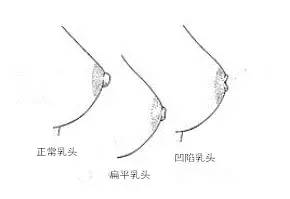 全球母乳喂养时间表,国际母乳学会关于母乳喂养的建议