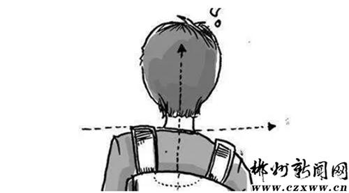 我终于可以昂首挺胸了！驼背男孩挺直了脊梁变翩翩少年