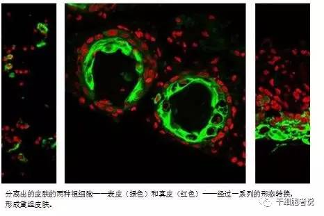 日本治疗脱发新研究,脱发治疗最新研究