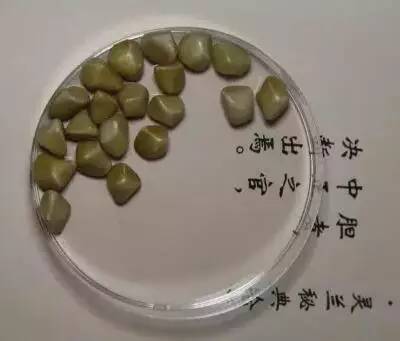 这个博物馆有点“疯狂”！2300份人体结石今天展出！就在东莞这个地方……