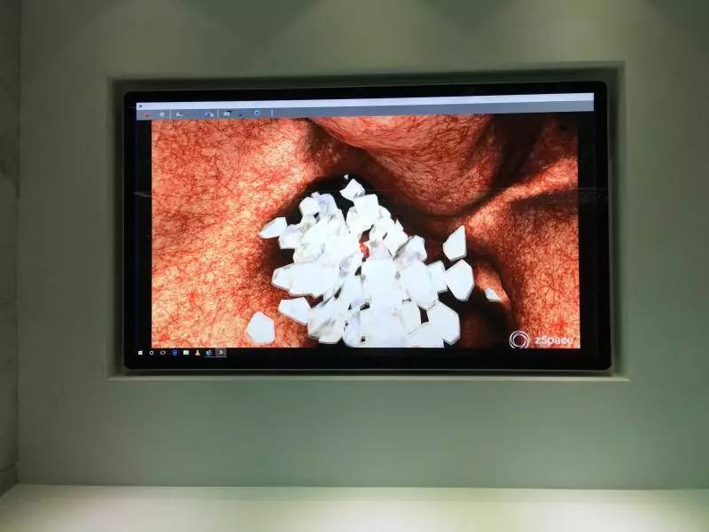 这个博物馆有点“疯狂”！2300份人体结石今天展出！就在东莞这个地方……