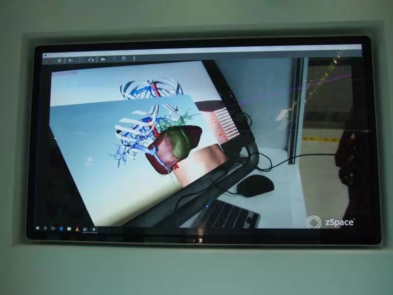 这个博物馆有点“疯狂”！2300份人体结石今天展出！就在东莞这个地方……