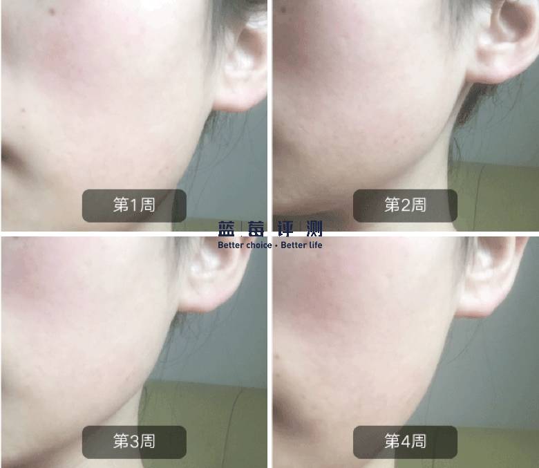 十大公认最好的美容仪,目前最好的美容仪是哪种