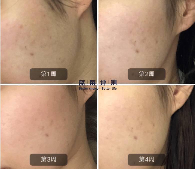 十大公认最好的美容仪,目前最好的美容仪是哪种