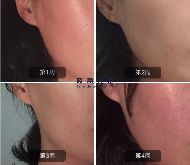 十大公认最好的美容仪,目前最好的美容仪是哪种