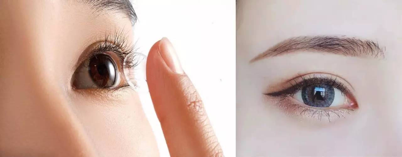 视力降落模糊要怎么保护,视力隐斜如何治疗