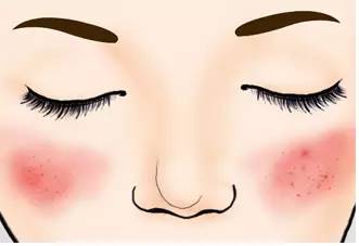 我们脸有多脏,我们的皮肤有多脏