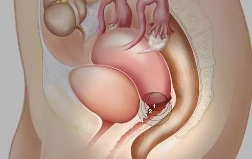 妇科主任给女性的10大建议,妇科专家总结