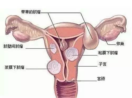 宫颈癌疫苗陕西4月预约时间,汉中宫颈癌怎么网上预约