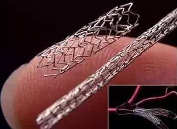 牙齿有金属填充物能不能做磁共振,做磁共振身上带金属会伤害身体吗