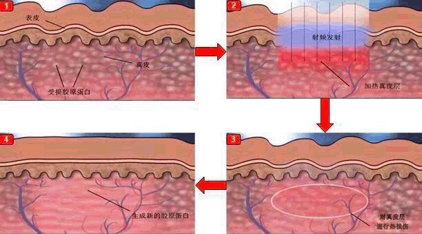 推荐美容仪的干货,美容仪真的有必要入手吗